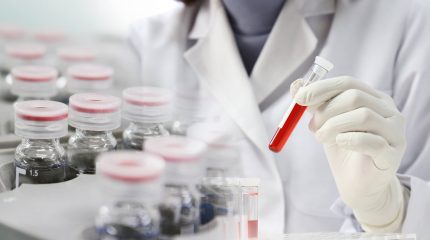 薬剤師資格を活かして研究職に転職するために必要な2つのポイント